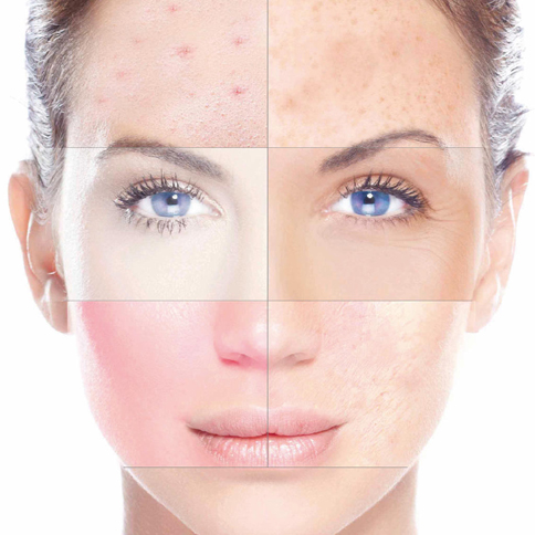 Aprenda a identificar os tipos de pele e cuidar corretamente